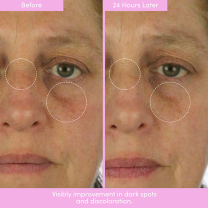 PEP TALK™ Bio-Placenta Barrier Repair Cream for Redness & Dryness