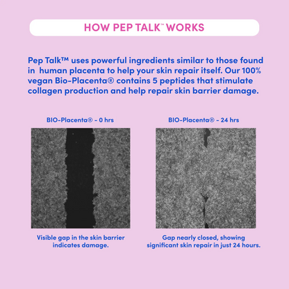 PEP TALK™ Bio-Placenta Barrier Repair Cream for Redness & Dryness